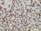 HMGB1 Antibody (monoclonal) (M02)